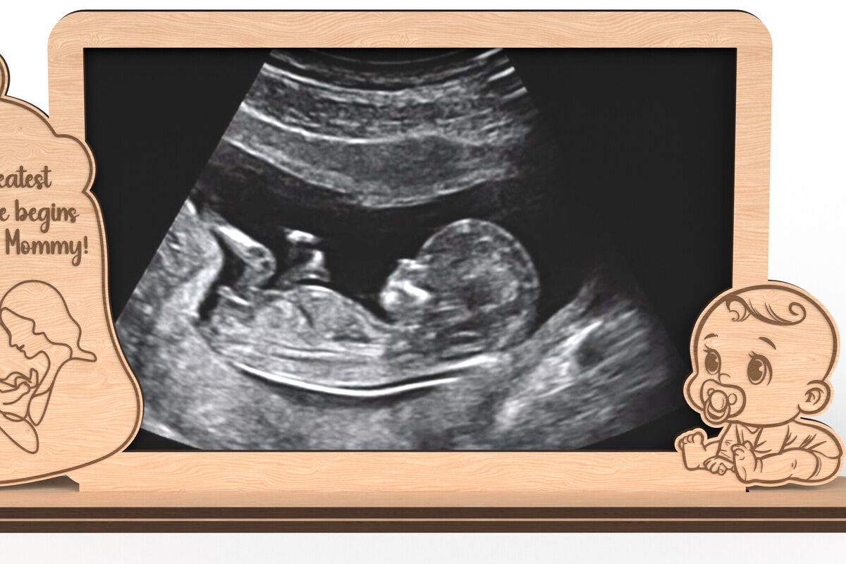 Intra απο ξύλο plywood 3mm-4mm πάχος Πλαίσιο υπερήχων Baby Footprint Δίασταση 30x20 cm INTRAFABR-117899153