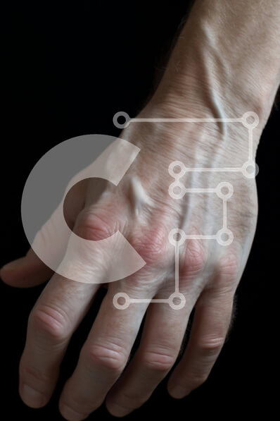 Intra Συλλεκτικό Ξύλινο Παζλ Plywood  4mm - Ανδρικό χέρι με τραυματισμό Σε Ξύλινο Κουτί - Διαστάσεις Puzzle: 10x10 cm – 25 κομμάτια