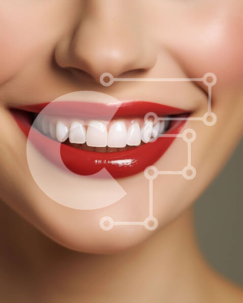 Intra Συλλεκτικό Ξύλινο Παζλ Plywood  4mm - Φωτεινό και όμορφο: Κοντινό πλάνο του χαμόγελου μιας γυναίκας με κόκκινο κραγιόν Σε Ξύλινο Κουτί - Διαστάσεις Puzzle: 10x10 cm – 25 κομμάτια