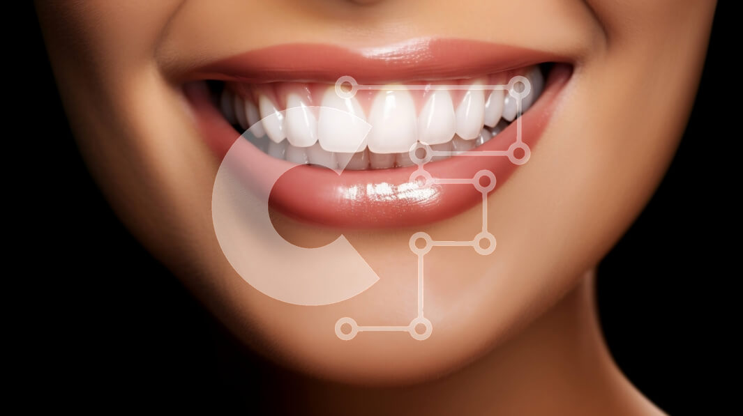 Intra Συλλεκτικό Ξύλινο Παζλ Plywood  4mm - Όμορφη εικόνα μιας χαμογελαστής γυναίκας με τέλεια δόντια Σε Ξύλινο Κουτί - Διαστάσεις Puzzle: 10x10 cm – 25 κομμάτια