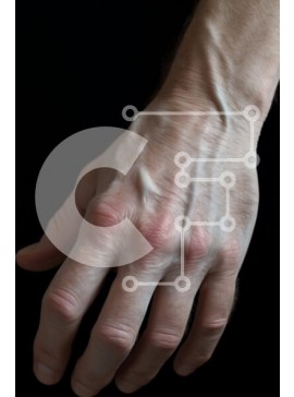 Intra Συλλεκτικό Ξύλινο Παζλ Plywood  4mm - Ανδρικό χέρι με τραυματισμό Σε Ξύλινο Κουτί - Διαστάσεις Puzzle: 10x10 cm – 25 κομμάτια