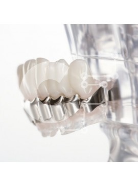 Intra Συλλεκτικό Ξύλινο Παζλ Plywood  4mm - Κοντινό πλάνο του Ορθοδοντικού Οδοντιατρικού Μοντέλου Σε Ξύλινο Κουτί - Διαστάσεις Puzzle: 10x10 cm – 25 κομμάτια